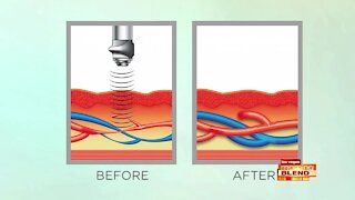 Breakthrough Treatment for E.D.