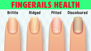 8 Things Your Nails Can Tell You About Your Health