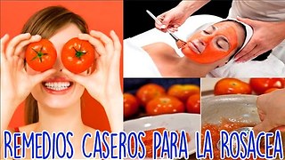 Remedios Caseros Para La Rosacea