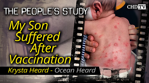 My Son Suffered After Vaccination