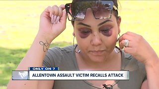 Only on 7: Allentown assault victim recalls attack