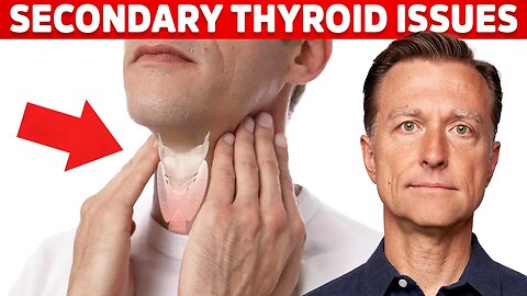 Most Thyroid Issues Are Secondary to Other Problems – Dr. Berg