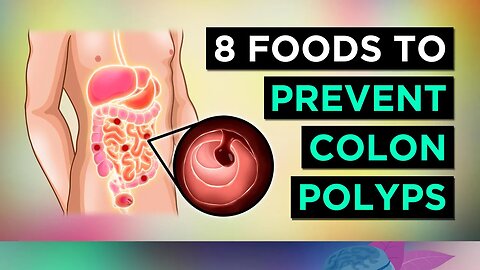 8 Foods To Prevent COLON POLYPS & BOWEL CANCER