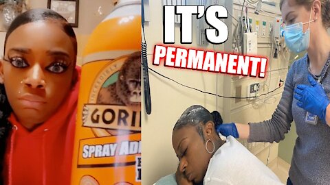 Silly Woman Uses Gorilla Glue On Her Hair & Goes To ER