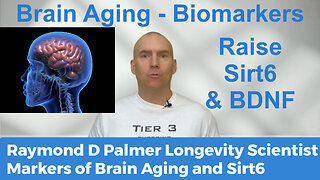 Brain Aging Biomarkers ‑ Sirt6 & BDNF