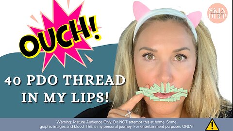The Incredible Transformation: My Jaw-dropping Experience With 40 Pdo Threads In My Lips!
