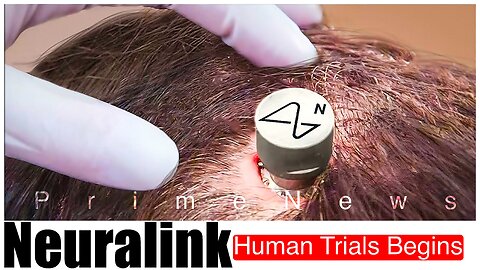 The Dawn of a New Era: Neuralink To Begin Human Trials