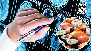 These foods can help an aging brain