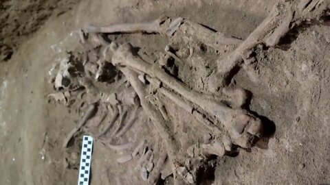 #94 Pesquisadores descobrem a 1ª cirurgia feita há 31 mil anos 13/09/22