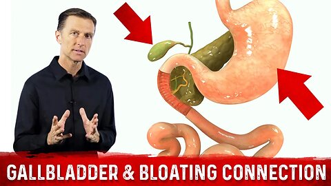 Gallbladder & Bloating Connection (Part 1) – Dr.Berg [Bloated Stomach & Gallbladder Function]