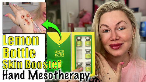 Lemon Bottle Skin Booster Hand Mesotherapy, AceCosm.com| Code Jessica10 Saves You Money