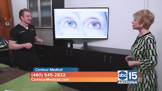 Contour Medical can help you get rid of the lines around your eyes
