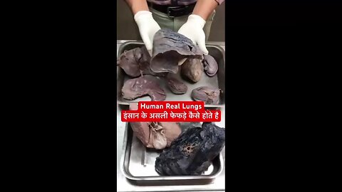 Lung extracted from dead body