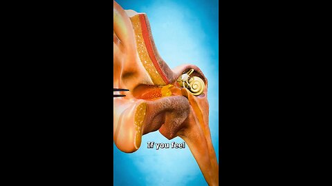 How To Properly Remove Ear Wax 😲 #ear #earwax