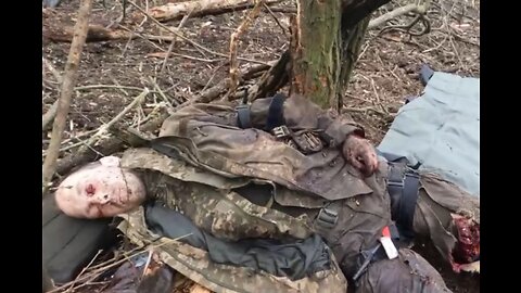 Ukrainians injured in Donba's battles, beg the Russian doctors to shoot them...!