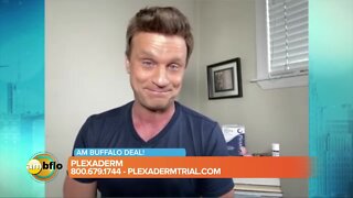 Plexaderm Offer for AM Buffalo Viewers