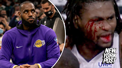 LeBron James suspended for Lakers-Knicks after bloodying Isaiah Stewart