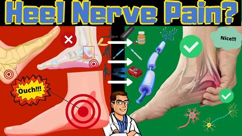 Nerve Heel Pain? [Plantar Fasciitis vs. Baxter's Nerve Entrapment FIX]