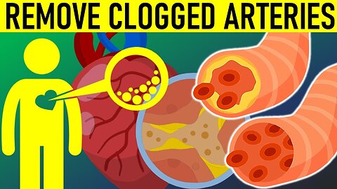 Surprising Ways to Unclog Your Arteries - You've Got to See These 11 Foods!