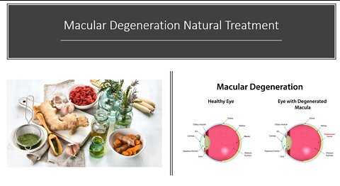 Macular Degeneration Natural Treatment