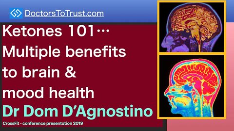 DOM D’AGNOSTINO 2 | Ketones 101…Multiple benefits to brain & mood health