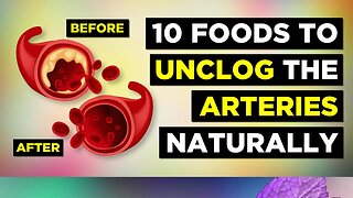 10 Foods That Clean Arteries and Prevent Heart Attacks Naturally