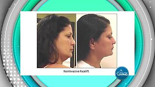 Absolute Beauty- Noninvasive Facelift