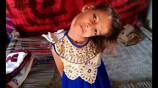 Nakken til dette pakistanske barnet står 90 grader feil