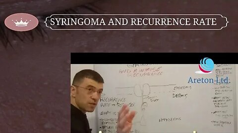 SYRINGOMA AN RECURRENCE RATE