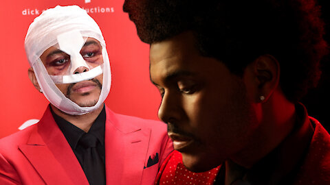 The Weeknd REVEALS Meaning Of Face Transformation & Bandages Ahead Of Superbowl!