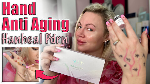 Hand Anti Aging with Hanheal PDRN, AceCosm | Code Jessica10 Saves you money