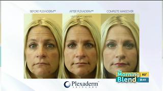 Plexaderm 7/19/17