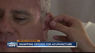 FINDING HOPE: Using acupuncture to live opioid-free