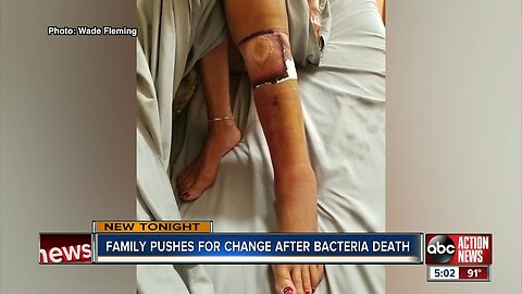 Woman dies from flesh-eating bacteria after visiting popular Manatee County beach
