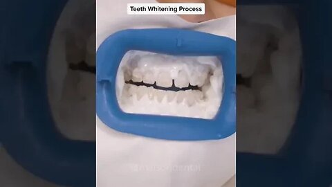 Dental And Teeth Hygiene