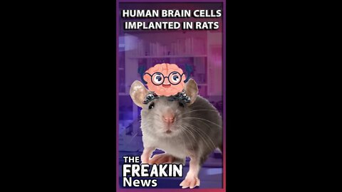 Scientists Transplant Human Brain Cells In Rats Sparking Optimism And Concerns