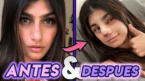 Mia K | Antes Y Después | Cirugías Estéticas