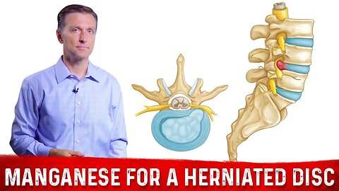 Take Manganese for Herniated Disc & Strengthening Ligaments – Dr.Berg