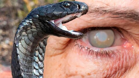 How to Survive a Spitting Cobra Attack