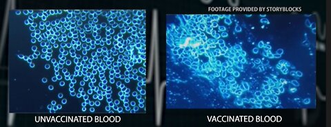 Foreign Compounds Found in Vaccines; Populations suffering new illness OAN