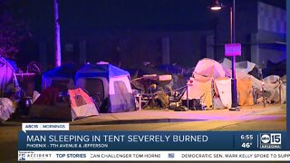 Person seriously burned in tent fire in Phoenix