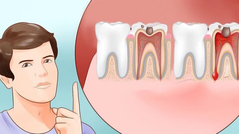 6 Proven Ways to Stop a Toothache and Relieve Pain