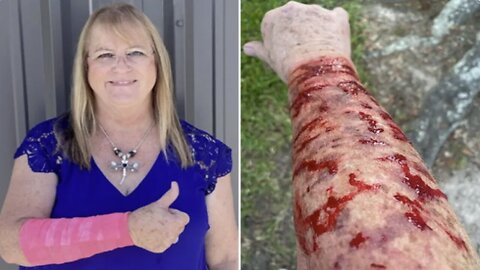Hawk drops 4-foot-long snake on Texas woman, prompting both animals to attack her