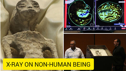 Mexican UFO expert conducts x-rays on 'non-human' beings presented at Congress