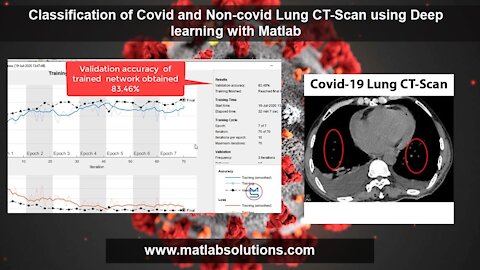Classification of Covid and Non-Covid Lungs CT-Scan using Deep Learning with MATLAB| MATLABsolutions