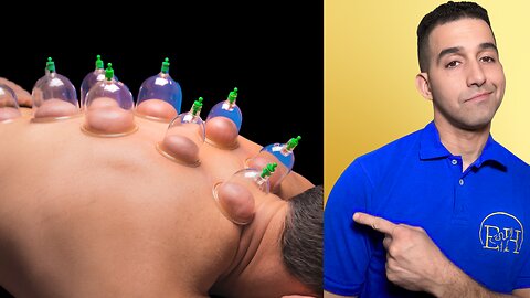 Unlocking the Benefits of Cupping Therapy in Massage Sessions