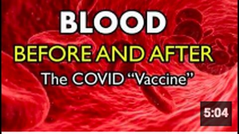 Blood Before and After the mRNA COVID