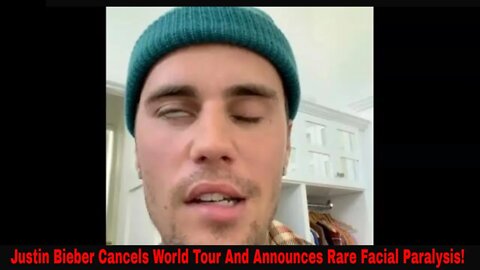 Justin Bieber Cancels World Tour Has Rare Facial Paralysis! (Video)