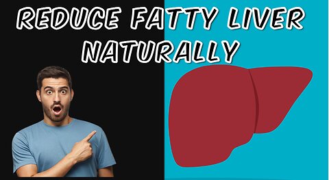 Foods that reduce Fatty Liver Naturally