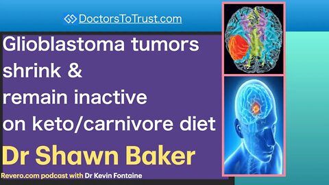 Shawn Baker 2 | Glioblastoma tumors shrink & remain inactive on keto/carnivore diet